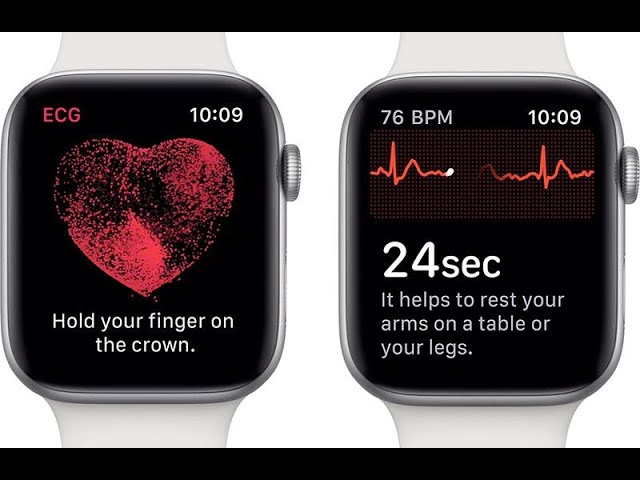 ¿Cómo activar la función electrocardiograma en Apple Watch?